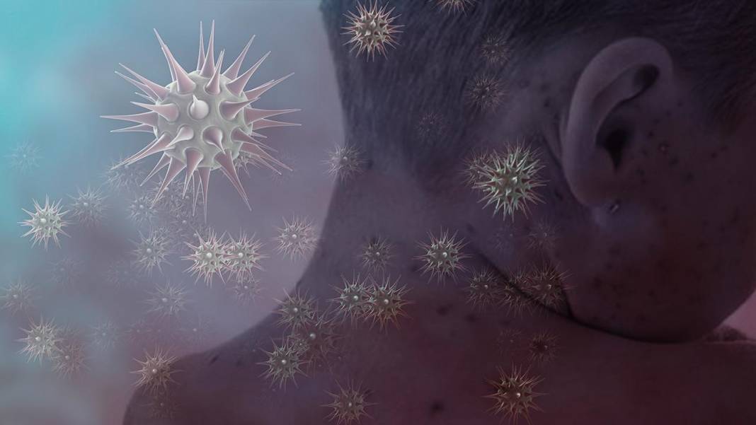 Boğazı yumuşatıp tıkanıklığı açıyor! Soğuk algınlığına karşı en etkili iksirler 8